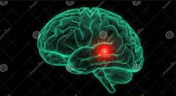 Brain spotting Canada: Evidence-Based Trauma Therapy and Certified Practitioners